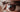 Can Laser Therapy Help with Eye Floaters and Vitreous Degeneration?