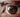 Can Laser Therapy Help with Eye Floaters and Vitreous Degeneration?