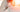Laser Therapy for Chronic Pelvic Pain in Women with PCOS