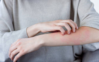 Red Light Therapy for Psoriasis and Eczema Relief