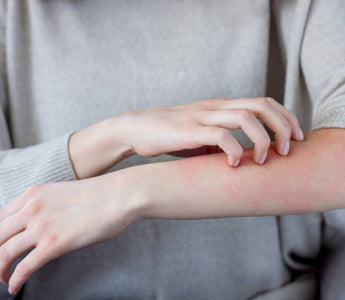 Red Light Therapy for Psoriasis and Eczema Relief