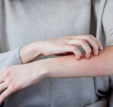 Red Light Therapy for Psoriasis and Eczema Relief