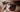 Can Laser Therapy Help with Eye Floaters and Vitreous Degeneration?