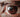 Can Laser Therapy Help with Eye Floaters and Vitreous Degeneration?