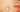 Cold Laser Therapy for Post-Inflammatory Hyperpigmentation (PIH)