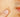 Cold Laser Therapy for Post-Inflammatory Hyperpigmentation (PIH)