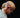 Cold Laser Therapy for Cervical Radiculopathy: Aiding Nerve Healing in the Neck