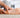 Laser Therapy for Plantar Fasciitis: Walking Without Heel Pain