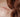 Cold Laser Therapy for Post-Surgical Scar Management: Enhancing Cosmetic and Functional Healing