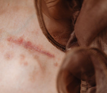 Cold Laser Therapy for Post-Surgical Scar Management: Enhancing Cosmetic and Functional Healing
