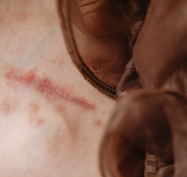 Cold Laser Therapy for Post-Surgical Scar Management: Enhancing Cosmetic and Functional Healing