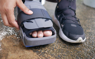 Laser Therapy for Nerve Pain in Amputees with Prosthetics