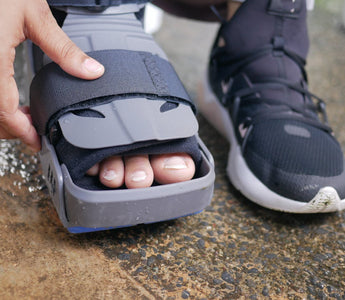 Laser Therapy for Nerve Pain in Amputees with Prosthetics