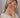 Laser Therapy for TMJ-Linked Ear Pain and Jaw Clicking