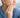 Red Light Therapy for Jawbone Health in Osteoporosis and TMJ Patients