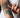 Using Cold Laser Therapy for Tattoo Removal Recovery